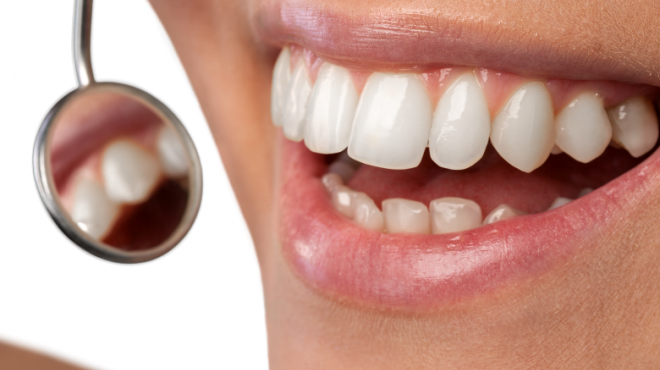 Come e perché si può sconfiggere la parodontite con la prevenzione