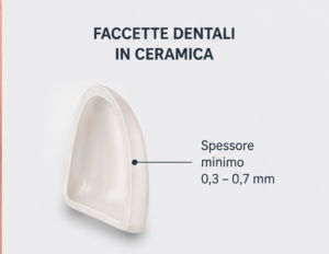 faccette dentali dentista valdarno