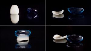 faccette dentali dentista valdarno
