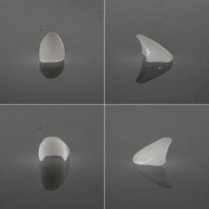 Quanto durano davvero le faccette dentali? Si possono staccare? Questa è probabilmente la seconda domanda che mi viene rivolta più spesso, subito dopo "Si vedranno?".