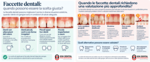 faccette dentali guida