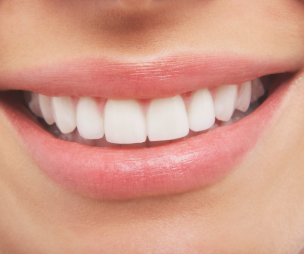 denti-del-giudizio-perche-esistono-e-perche-spesso-creano-fa