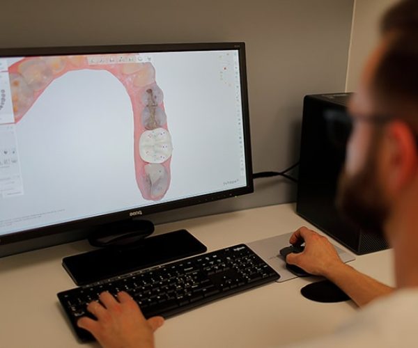 protesi-dentale-cad-cam